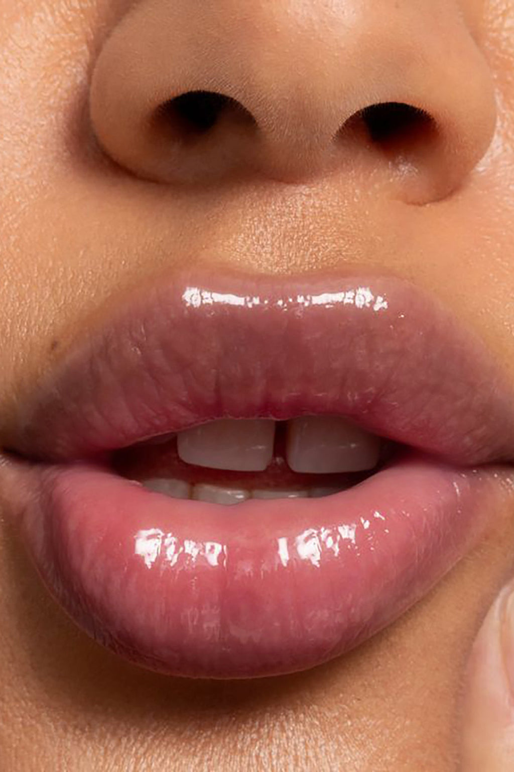 LIPID